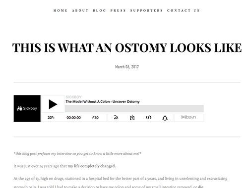 Uncover-Ostomy_This-is-what-an-ostomy-looks-like_SickBoyPodcast_4-6-2017