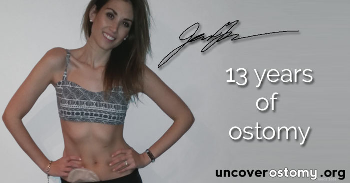 Uncover Ostomy 13 years FB Banner