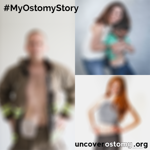 uncover ostomy announcement picture
