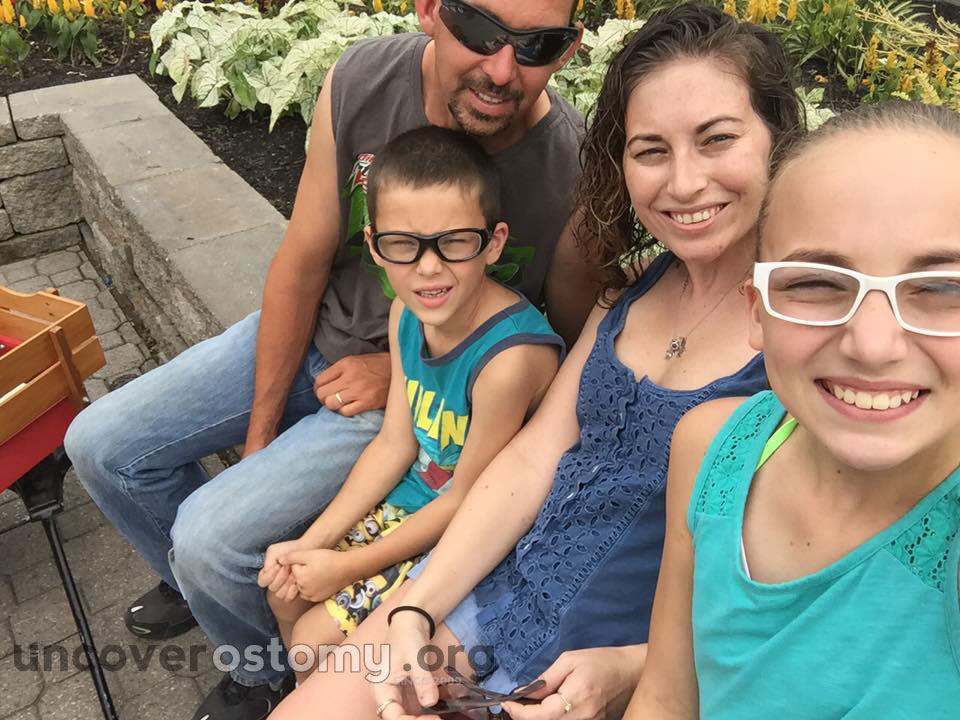 uncover-ostomy-susan-family