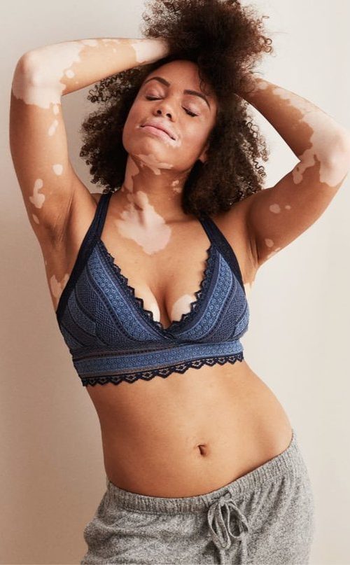 The #AerieREAL Body Positivity Campaign Includes an Ostomate