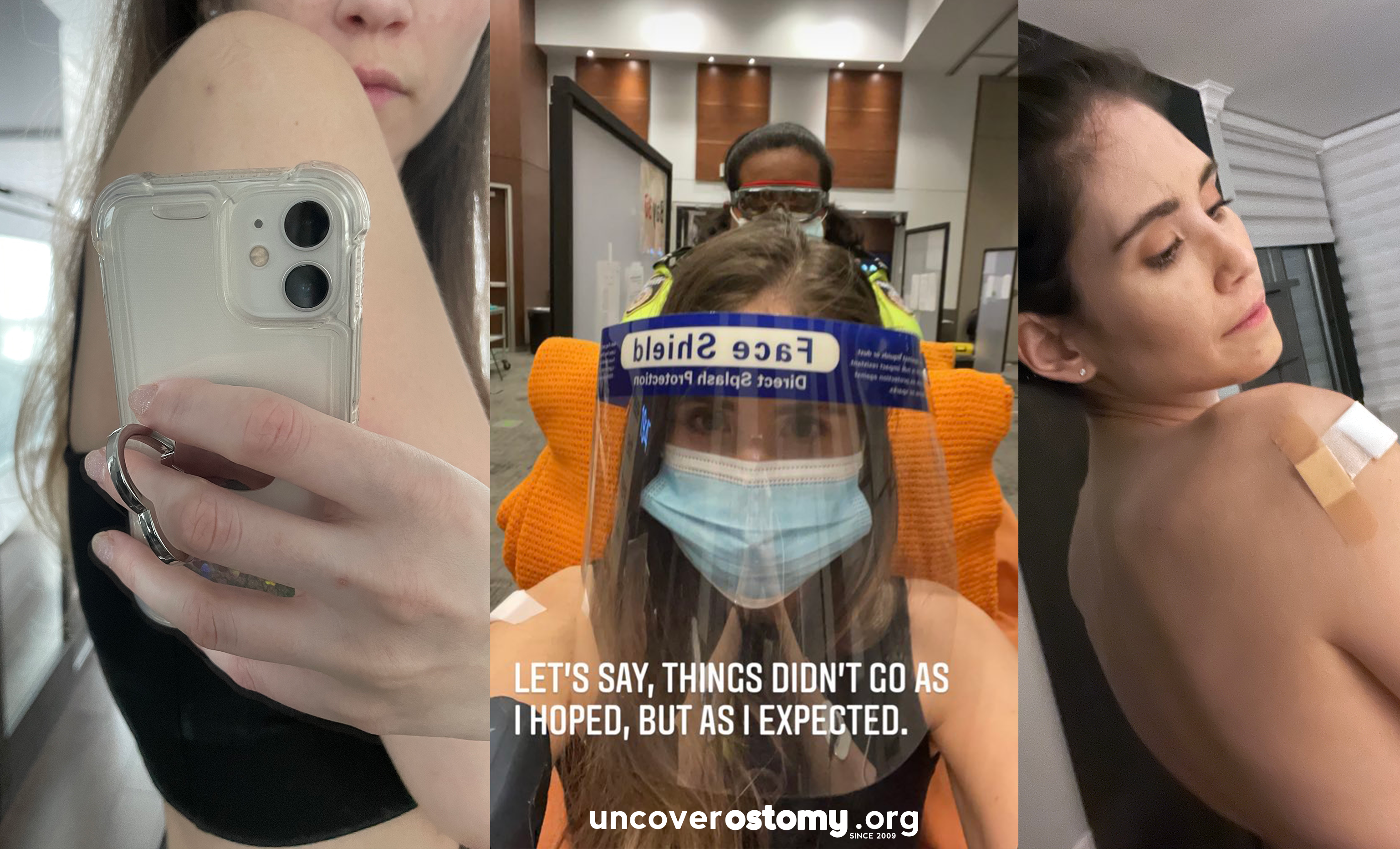 Ostomy Awareness: The #AerieREAL Campaign - Uncover Ostomy